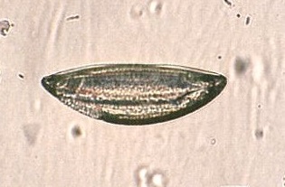 わんにゃん通信no 1113 蟯虫検査 応用生物科学科blog