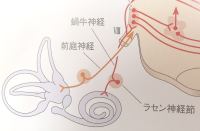 pict-蝸牛前庭神経